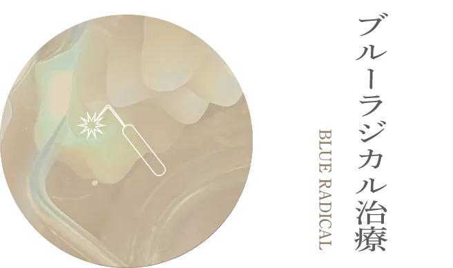 ブルーラジカル治療